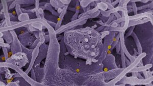 We were told the gut was our second brain — Now doctors say the body may hide a third control center 41 Third control center revealed by science