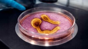 Scientists spent 20 years chasing a cholera mystery until they discovered bacteria can choose between survival and becoming more lethal 9 Study explains cholera lethality