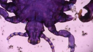 Eradicated in the 1970s, a flesh-eating parasite has just turned up in a Texas calf — and cattle officials are alarmed 25 alexander zabrodskiy uirOJUpnows unsplash