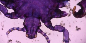 File image of a parasite