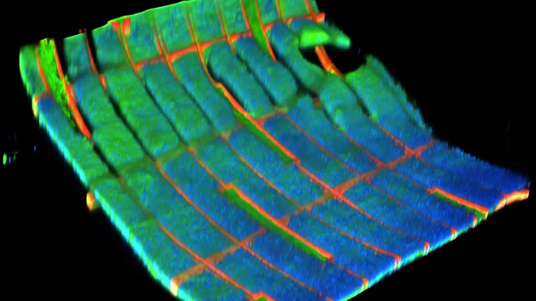 Cardiac mesh