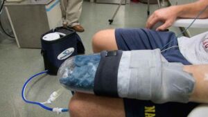 A lab volunteer who could manage 180 pull ups in a session reached more than 620 in six weeks of cooling one palm between sets, though later trials have not repeated the effect 11 Research assistant using a palm cooling glove between pull-up sets in a university lab, lab volunteer who