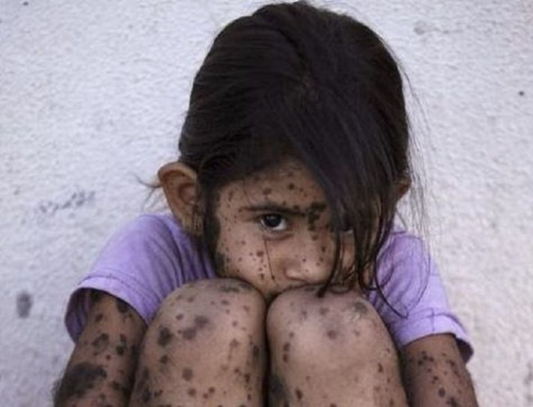Niños, agrotóxicos y daño genético en el Garraham 5 Niños, agrotóxicos y daño genético en el Garraham