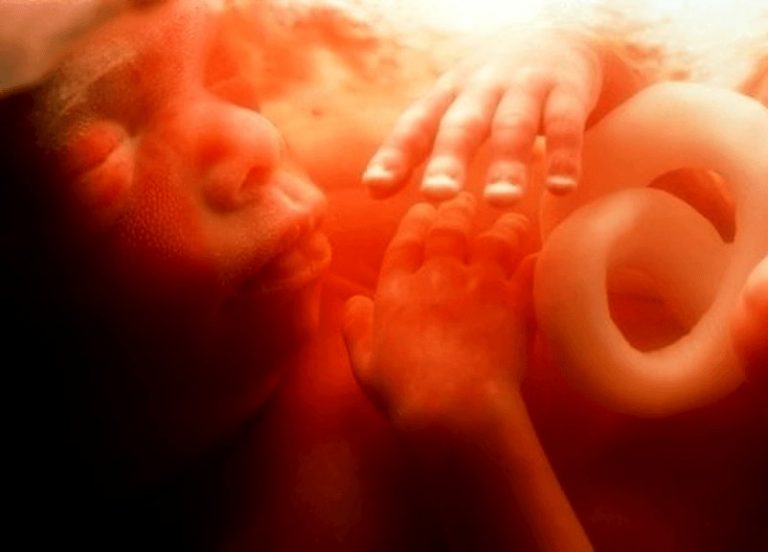 El glifosato impide el desarrollo embrionario y fetal 2 El glifosato impide el desarrollo embrionario y fetal