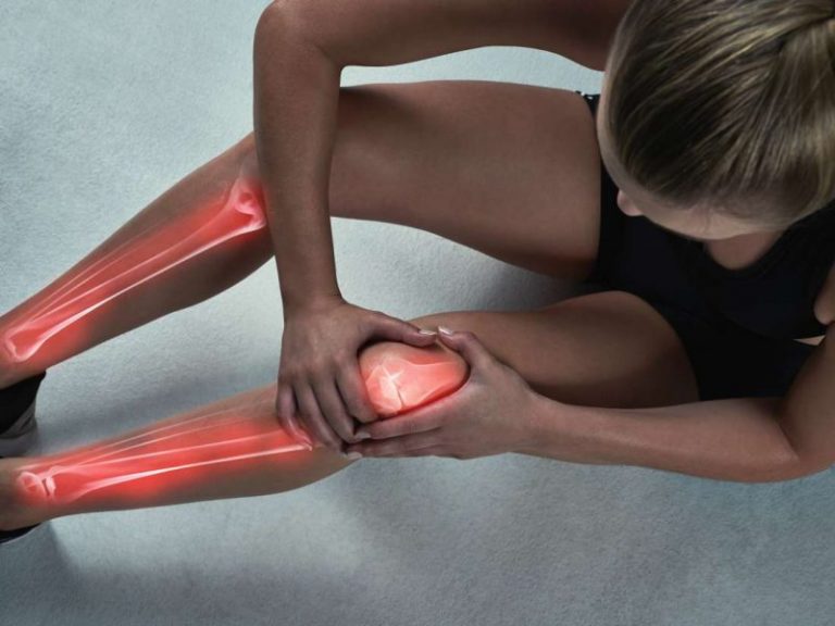 12 remedios naturales para aliviar el dolor de rodilla