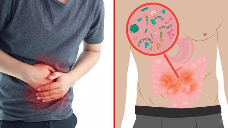 Sobrecrecimiento bacteriano podría ser la causa de problemas estomacales