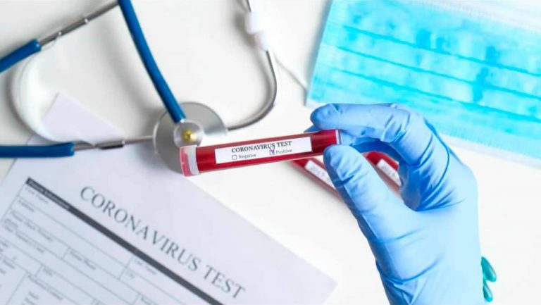 Coronavirus: 10 preguntas que todavía no tienen respuesta científica 6 Coronavirus: 10 preguntas que todavía no tienen respuesta científica