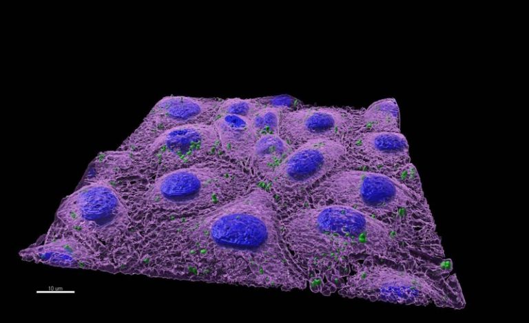 Los nanoplásticos alteran el microbioma intestinal 6 Los nanoplásticos alteran el microbioma intestinal