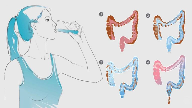 Enjuague de agua salada como limpieza de colon 9 Enjuague de agua salada como limpieza de colon