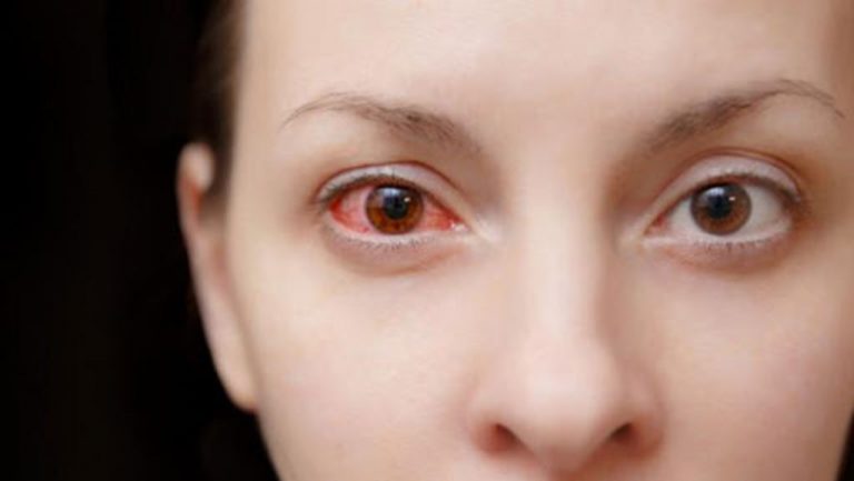 Deberías adoptar estos 15 hábitos, para cuidar la salud de tus ojos 5 Deberías adoptar estos 15 hábitos, para cuidar la salud de tus ojos