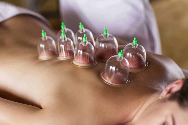 Ventosas: técnica milenaria con beneficios únicos para la salud 4 Ventosas: técnica milenaria con beneficios únicos para la salud