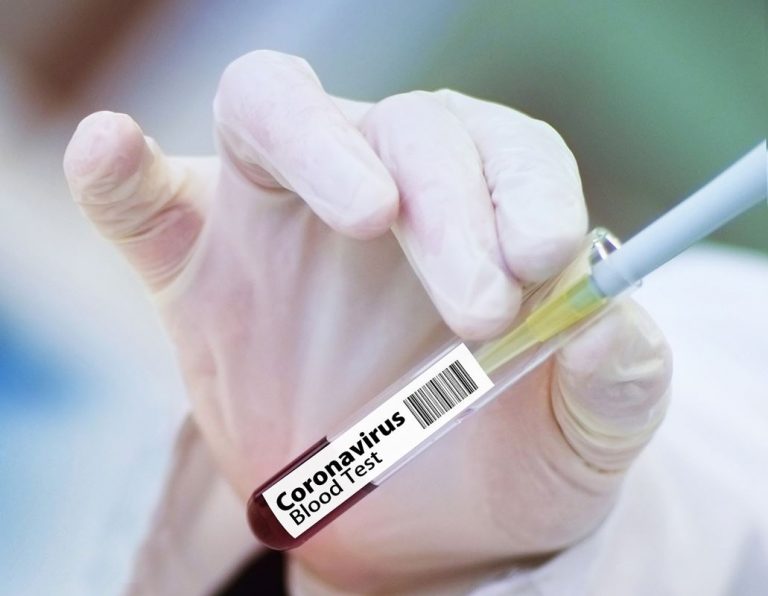 ¿Cómo puede una vacuna COVID causar coágulos de sangre? 1 ¿Cómo puede una vacuna COVID causar coágulos de sangre?