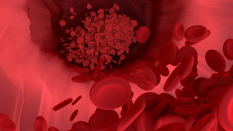 Los 10 mejores anticoagulantes naturales 9 Los 10 mejores anticoagulantes naturales