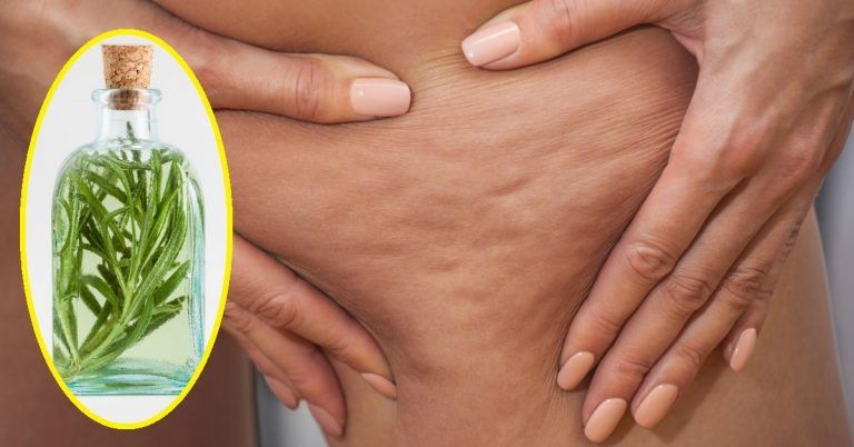 5 aceites esenciales para reducir la celulitis 6 5 aceites esenciales para reducir la celulitis