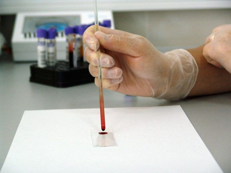 Preocupante: Encuentran Microplásticos en sangre humana, por primera vez 3 Preocupante: Encuentran Microplásticos en sangre humana, por primera vez