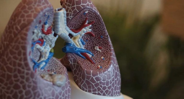 Descubren Microplásticos en los pulmones de personas vivas 10 Descubren Microplásticos en los pulmones de personas vivas