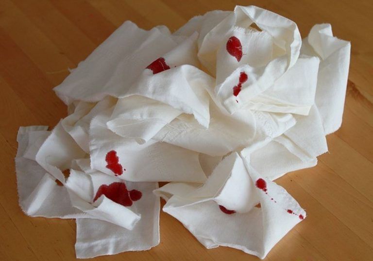 ¿Cómo quitar manchas de sangre de la ropa fácilmente? 2 ¿Cómo quitar manchas de sangre de la ropa fácilmente?