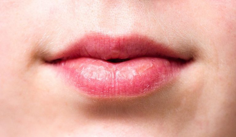 7 causas de los labios secos y cómo hacerlos suaves 7 7 causas de los labios secos y cómo hacerlos suaves