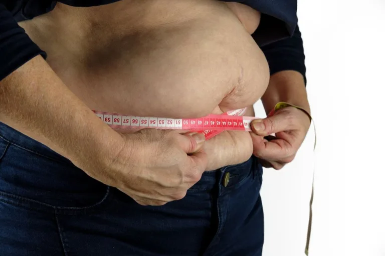 Aumenta la obesidad en los países pobres por el costo de alimentos saludables 2 Aumenta la obesidad en los países pobres por el costo de alimentos saludables
