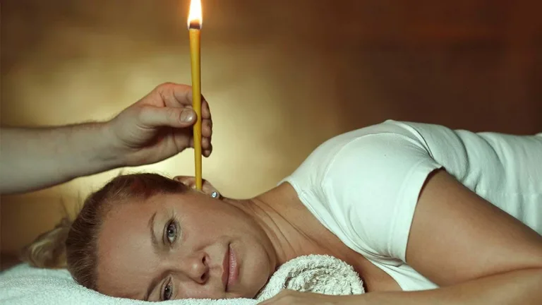 Técnica de las Velas de oído para eliminar tapones de cera 1 Técnica de las Velas de oído para eliminar tapones de cera