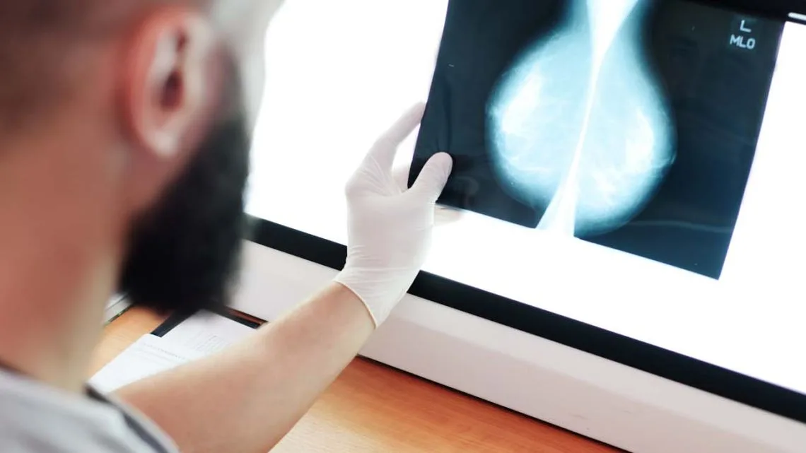 cáncer de mama