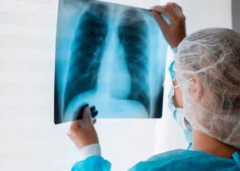 tuberculosis